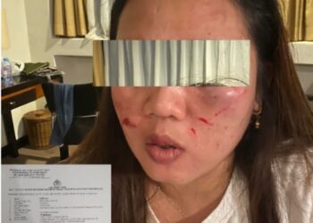 WOOW HEBOH..!! STAFF PENDAMPING KOMISI DPRD TANGGAMUS ANIAYA REKANNYA SENDIRI HINGGA LUKA PARAH..!!