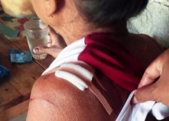 Warga Semaka Diduga di Terkam Buaya Satu Hilang Dan Satu Luka-Luka