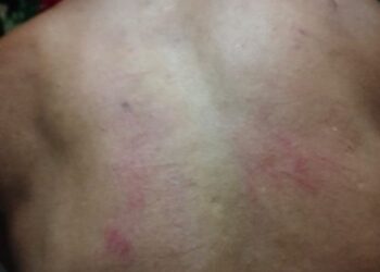 APH Polres Kampar Diminta Tangkap dan usut sampai tuntas Dugaan Pelaku Kekerasan ke Wartawan di Desa lV Koto Setingkai