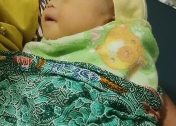 ” Butuh Donasi ” Warga Pekon Napal Kecamatan Kelumbayan Melahirkan Bayi TANPA ANUS.
