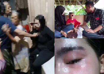Dugaan Kekerasan terhadap Perempuan dan Anak Terjadi di Citangkil, Kasus Dua Bulan Berlalu Tanpa Tindak Lanjut APH